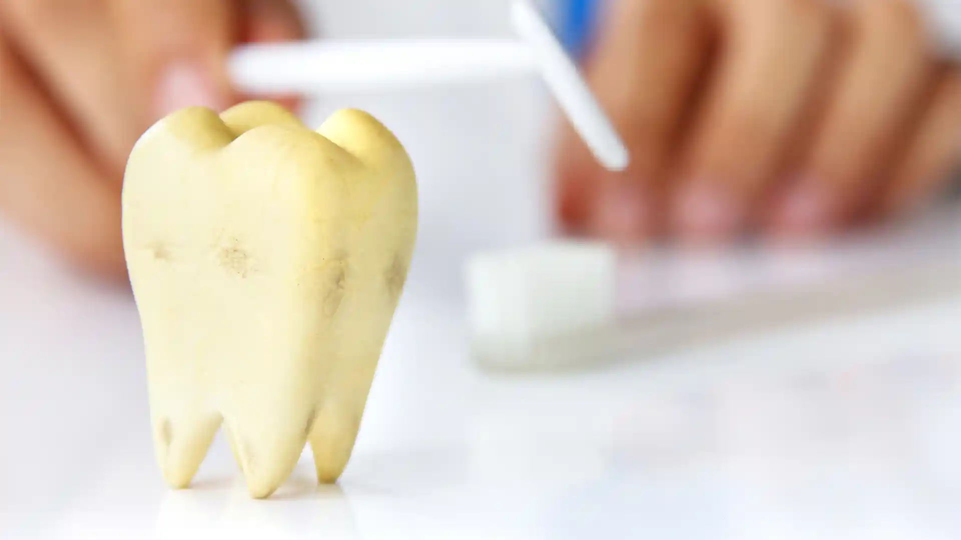 Tooth Decay Treatment